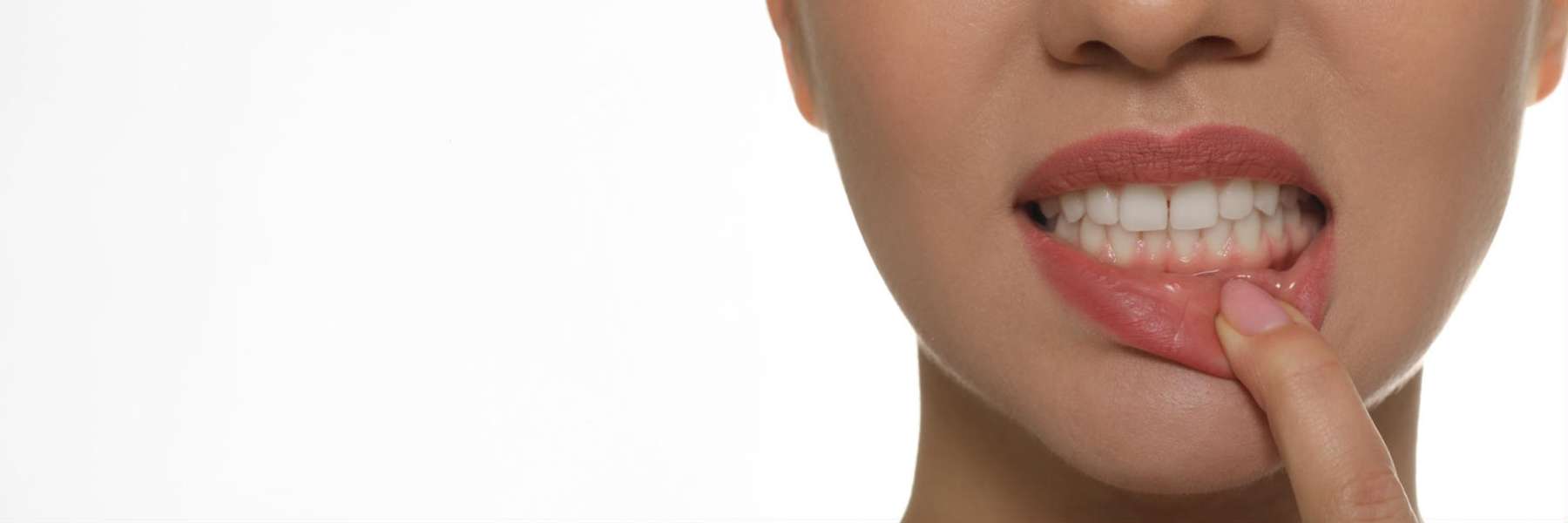Periodontal Treatment | Dentist
